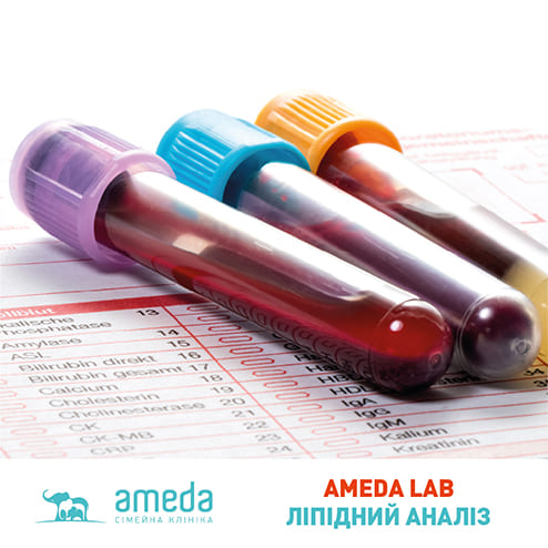 Ameda