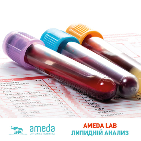 Ameda